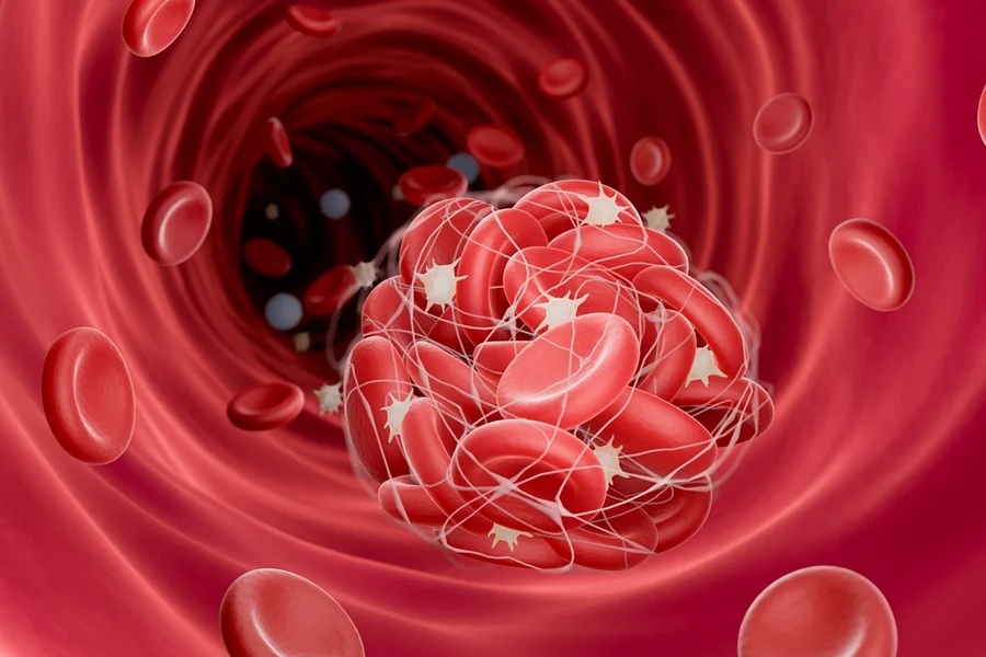 Parafacial lateral pode explicar hipertensão resistente a remédios